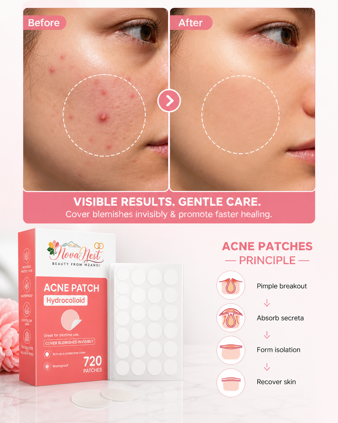 RapidHeal Acne Patches
